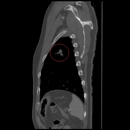 파일:body04 003 001 004.jpg