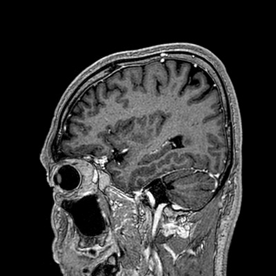 파일:body04 037 3d t1 tfe ce 2.jpg