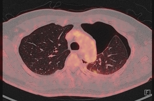 파일:body04 035 003.jpg