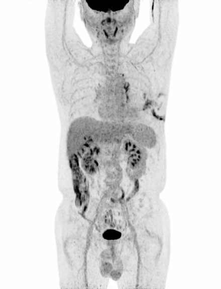 파일:body04 035 005.jpg