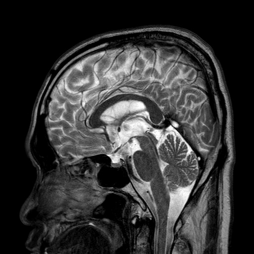 파일:body04 037 t2 tse sag.jpg