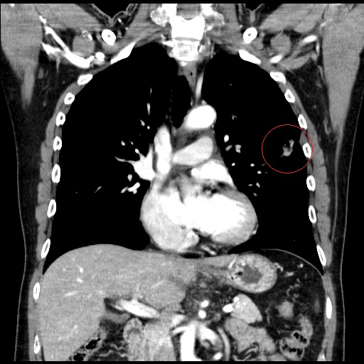 파일:body04 003 001 003.jpg