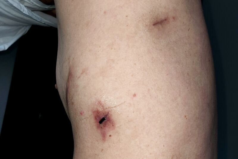 파일:body04 030 002.jpg