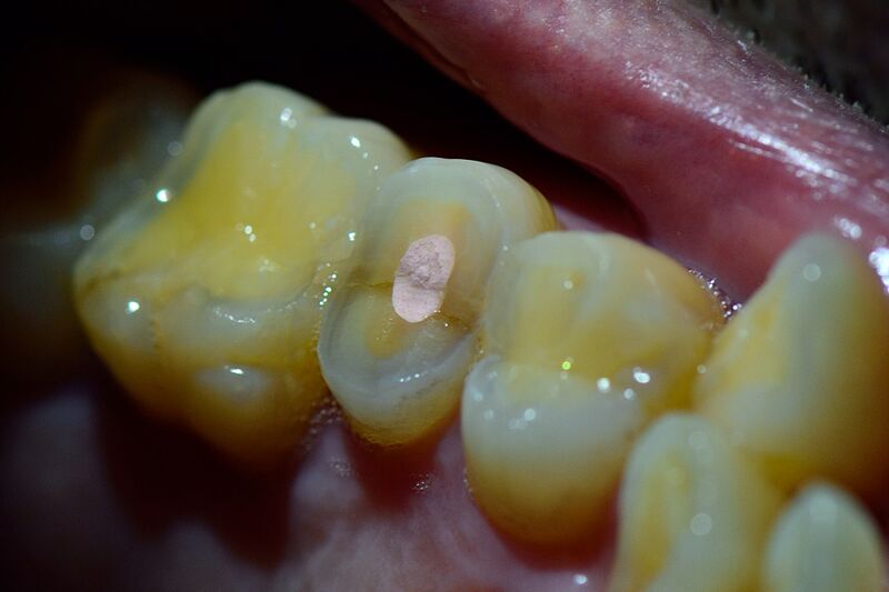 파일:body01 001.jpg