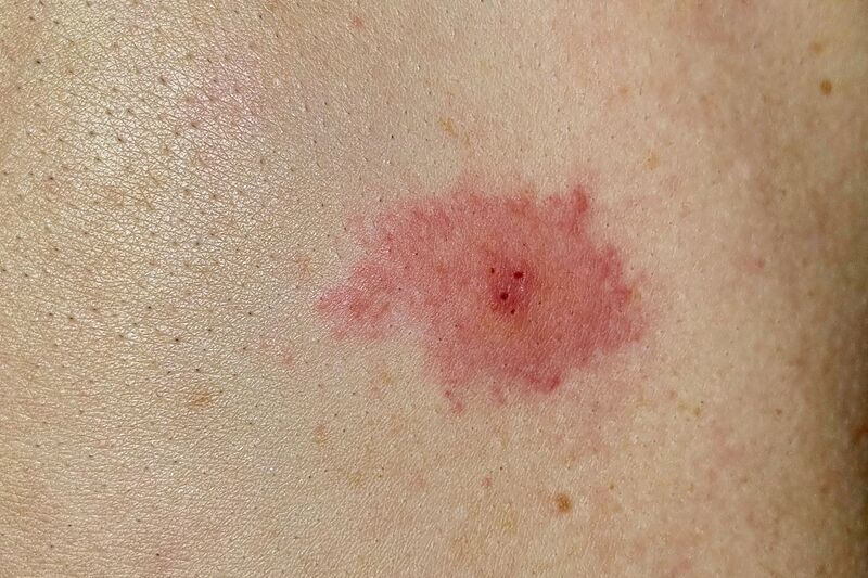 파일:body05 001.jpg