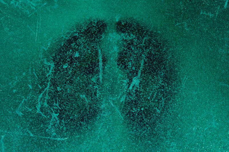 파일:avm13 038.jpg