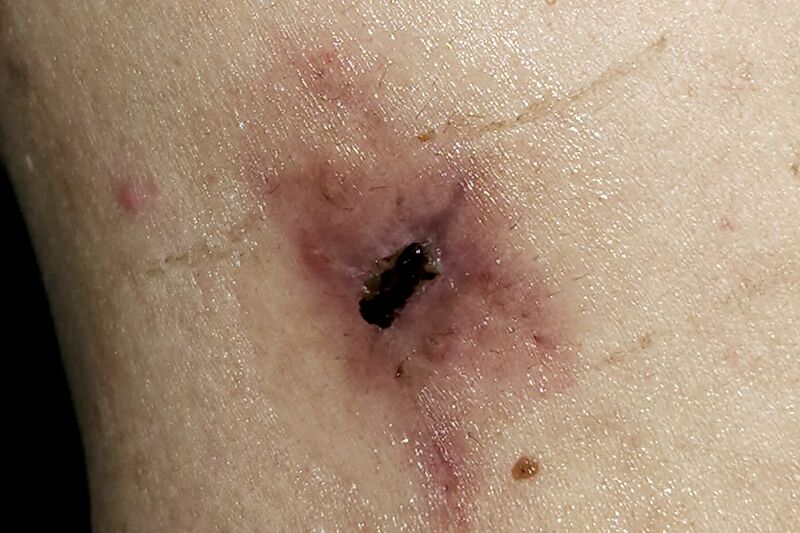 파일:body04 030 003.jpg